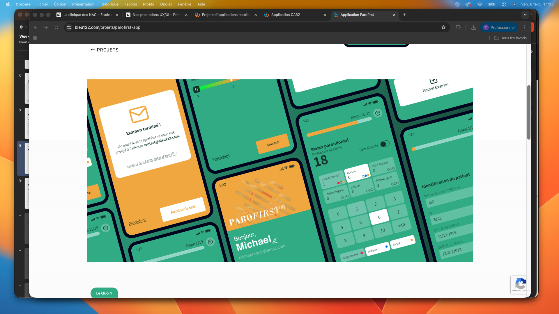 Illustration du projet Application d’examens parodontaux au service des dentistes