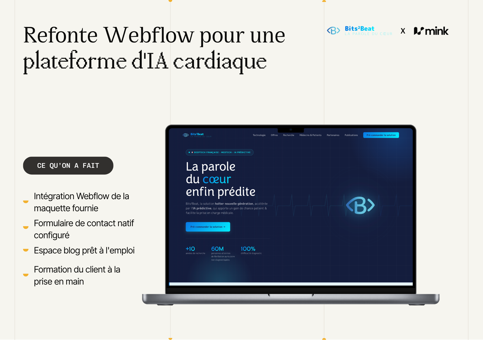 Illustration du projet Refonte Webflow pour une plateforme d'IA cardiaque