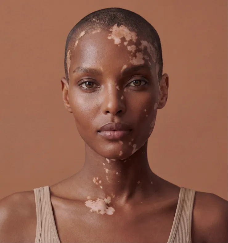 Illustration du projet Production de mannequins virtuels IA pour la collection hiver Bensimon